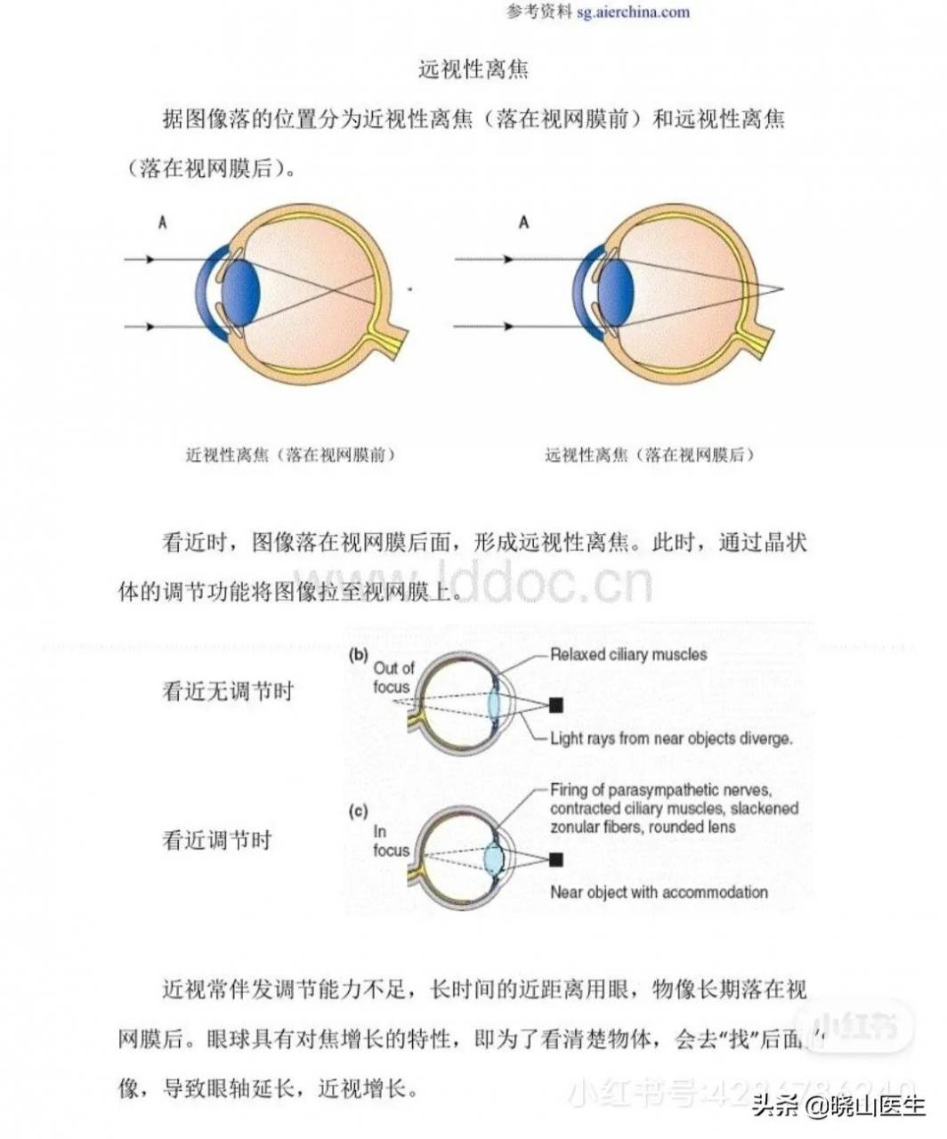 大夫不建議使用星趣控鏡片