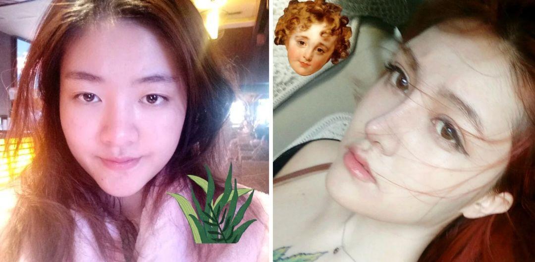 為什么整容變化那么大(為什么我整容沒有太大的變化)