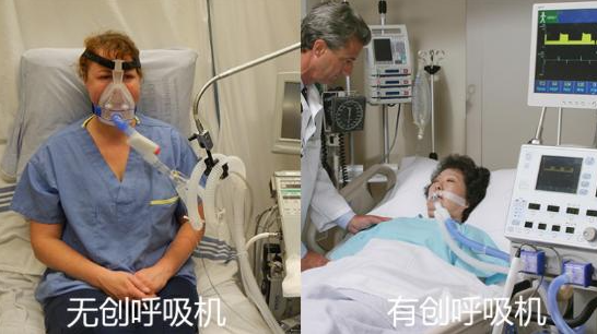 為什么拔掉呼吸機就不能呼吸(脫離呼吸機就不能呼吸了怎么辦)