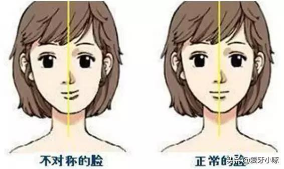 為什么拍照臉不對稱嘴有點歪(前置拍照嘴歪臉不對稱怎么辦)