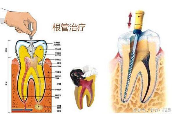 為什么長小肉球(為什么牙旁邊長小肉球)