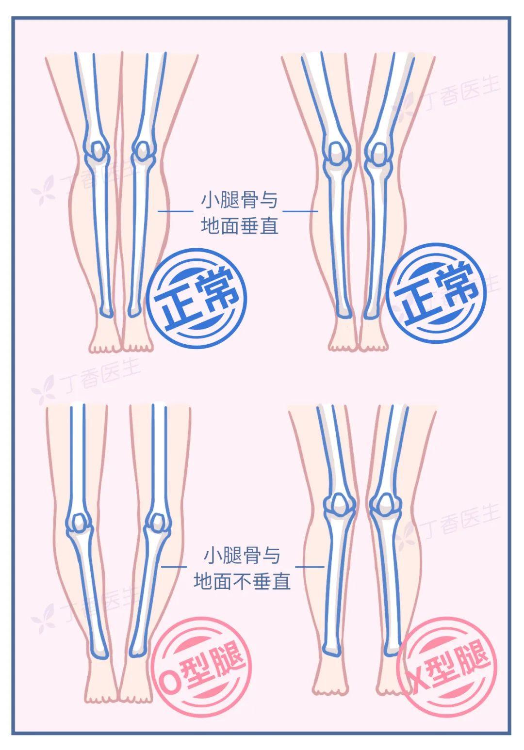 為什么女的腿都不直(為什么要看女的腿)