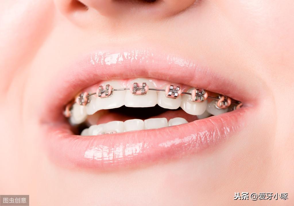 為什么拍照臉不對稱嘴有點歪(前置拍照嘴歪臉不對稱怎么辦)