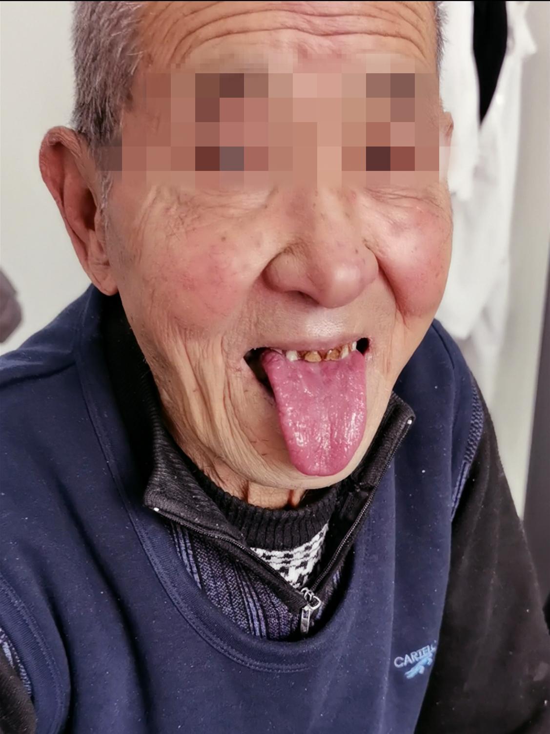 為什么臉紅是紫色(臉紅為什么是粉紫色的)