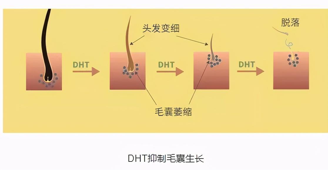 為什么禿頭從前面開始(為什么開始禿頭了)