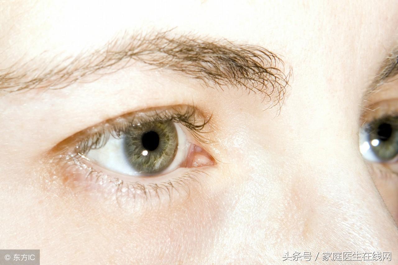 為什么眼瞳是黃色的(為什么有的人眼珠是黃色的)