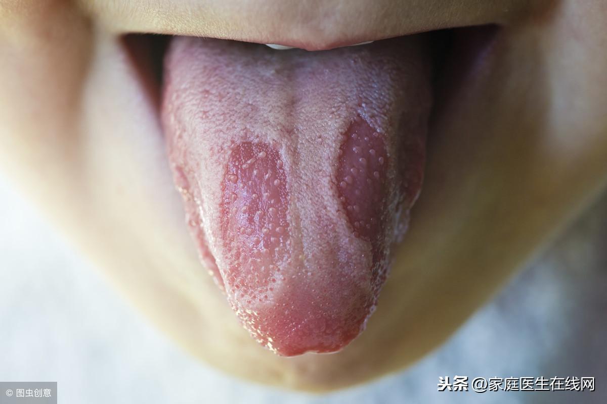 為什么我的舌頭邊上帶花邊(舌頭邊上下面長(zhǎng)泡為什么)