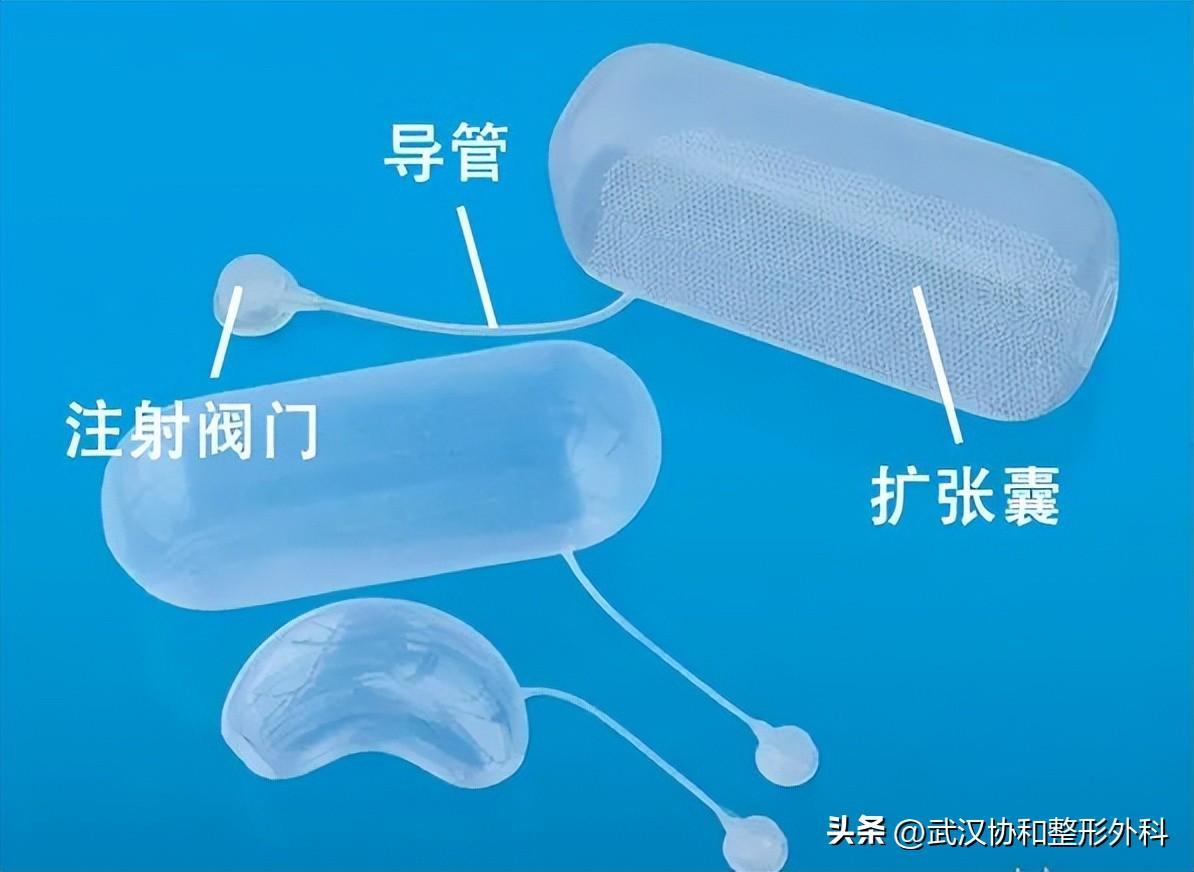 棉簽冰塊夾子擴張器是干嘛用的(皮膚擴張器的作用)