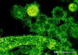 貓傳腹是怎么引起的(罪魁禍首是貓冠狀病毒)
